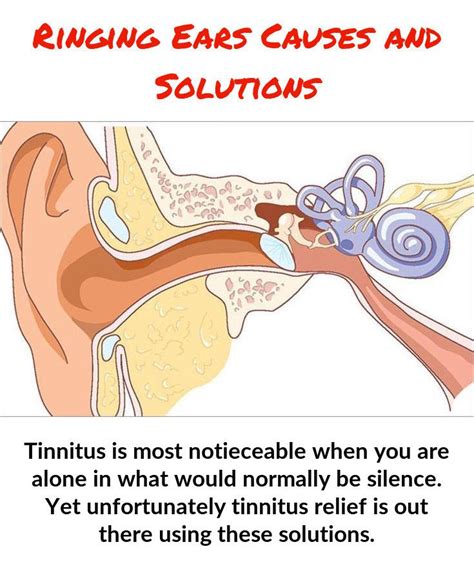 can cleaning ears cause tinnitus